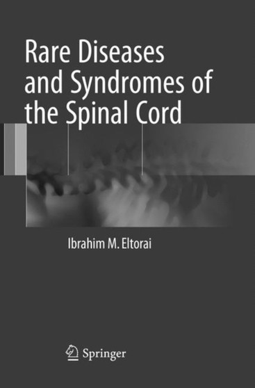 Rare Diseases and Syndromes of the Spinal Cord by Ibrahim M. Eltorai - Paperback