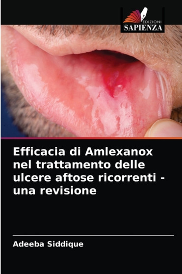Efficacia di Amlexanox nel trattamento delle ulcere aftose ricorrenti - una revisione by Adeeba Siddique - Paperback