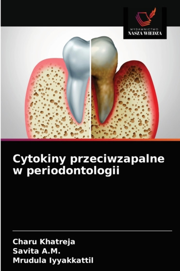 Cytokiny przeciwzapalne w periodontologii by Charu Khatreja - Paperback