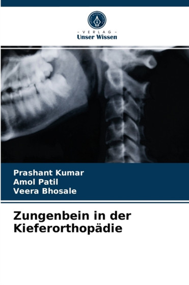 Zungenbein in der Kieferorthopadie by Prashant Kumar - Paperback