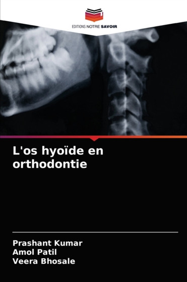 L'os hyoide en orthodontie by Prashant Kumar - Paperback