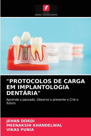 "Protocolos de Carga Em Implantologia Dentaria" by Jehan Dordi - Paperback