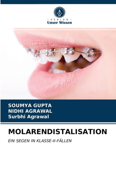 Molarendistalisation by Soumya Gupta - Paperback
