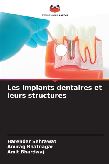 Les implants dentaires et leurs structures by Harender Sehrawat - Paperback