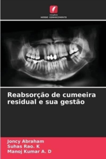 Reabsorcao de cumeeira residual e sua gestao by Joncy Abraham - Paperback