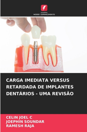 Carga Imediata Versus Retardada de Implantes Dentarios - Uma Revisao by Celin Joel C - Paperback