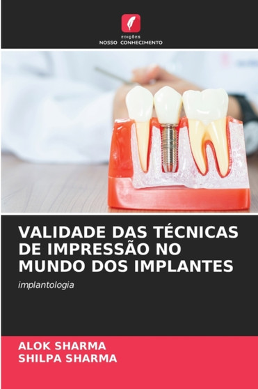 Validade Das Tecnicas de Impressao No Mundo DOS Implantes by Alok Sharma - Paperback