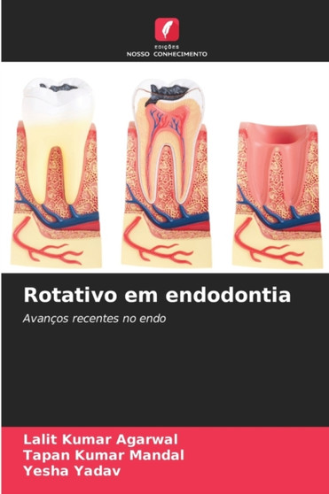 Rotativo em endodontia by Lalit Kumar Agarwal - Paperback