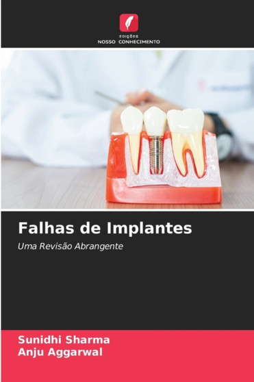 Falhas de Implantes by Sunidhi Sharma - Paperback