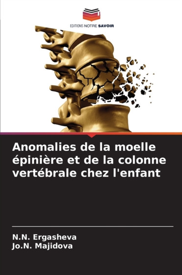 Anomalies de la moelle epiniere et de la colonne vertebrale chez l'enfant by N N Ergasheva - Paperback