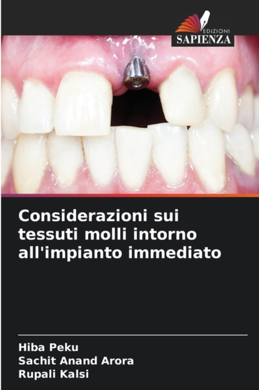 Considerazioni sui tessuti molli intorno all'impianto immediato by Hiba Peku - Paperback