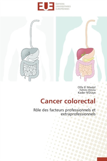 Cancer Colorectal by Collectif - Paperback