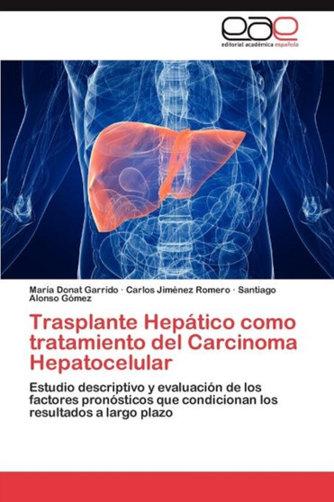 Trasplante Hepatico como tratamiento del Carcinoma Hepatocelular by Donat Garrido Maria - Paperback