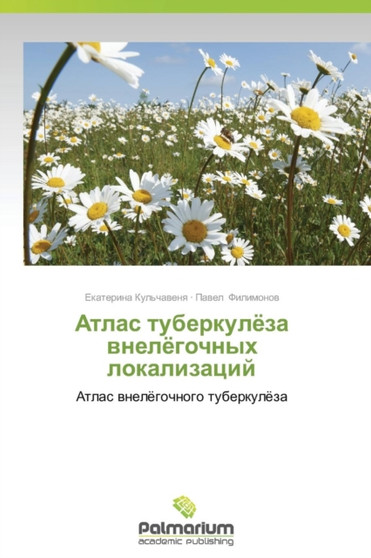 Atlas Tuberkulyeza Vnelyegochnykh Lokalizatsiy by Kul'chavenya Ekaterina - Paperback