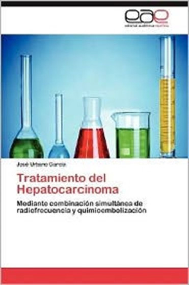 Tratamiento del Hepatocarcinoma by Jos Urbano Garc a - Paperback