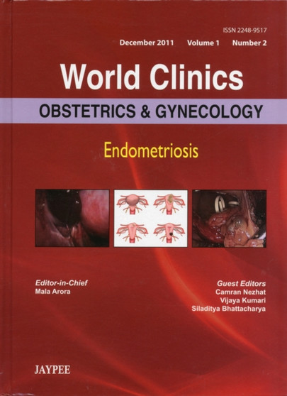World Clinics: Obstetrics & Gynecology : Endometriosis by Mala Arora - Hardback