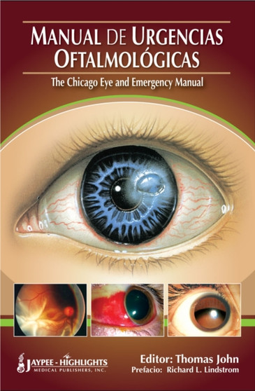 Manual de Urgencias Oftalmologicas - "The Chicago Eye and Emergency Manual" by Thomas John - Paperback