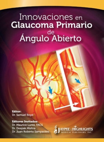 Innovaciones en Glaucoma Primario de Angulo Abierto by Samuel Boyd - Hardback