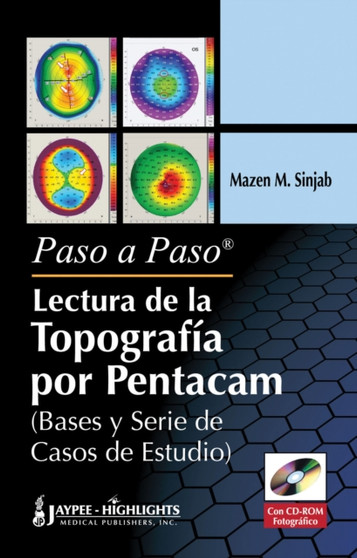 Paso a Paso - Lectura de la Topografia por Pentacam by Mazen M Sinjab - Hardback