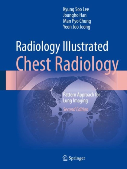 Radiology Illustrated: Chest Radiology : Pattern Approach for Lung Imaging by Kyung Soo Lee - Hardback