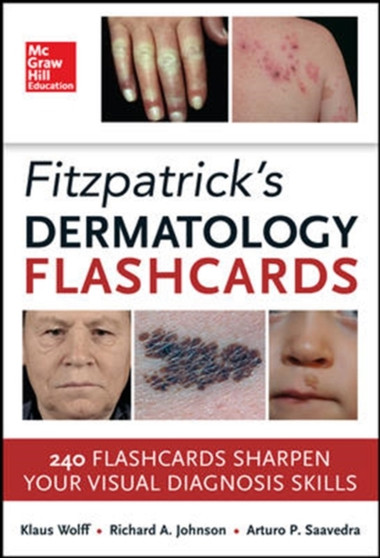Fitzpatricks Dermatology Flash Cards by Klaus Wolff - Paperback