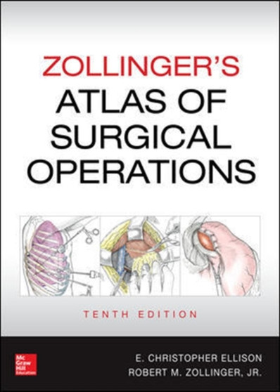 Zollinger's Atlas of Surgical Operations, Tenth Edition by Robert Zollinger - Hardback