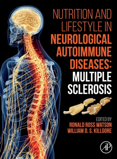 Nutrition and Lifestyle in Neurological Autoimmune Diseases : Multiple Sclerosis by Ronald Ross Watson - Hardback