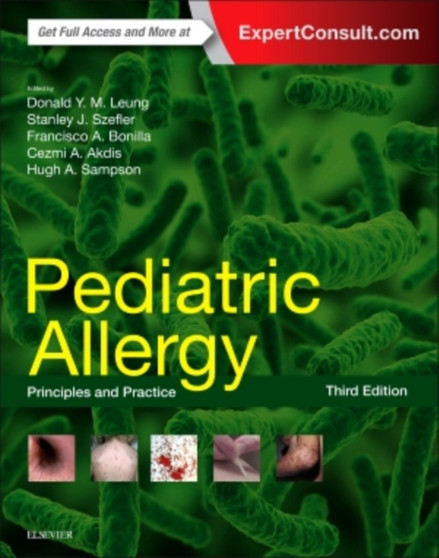 Pediatric Allergy: Principles and Practice by Stanley J. Szefler - Hardback