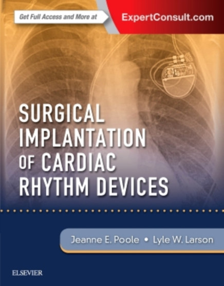Surgical Implantation of Cardiac Rhythm Devices by Jeanne Poole - Hardback