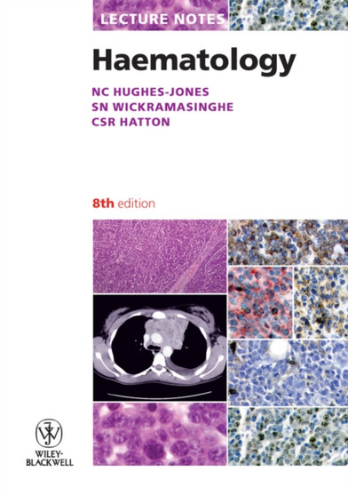 Lecture Notes: Haematology by Nevin C. Hughes-Jones - Paperback