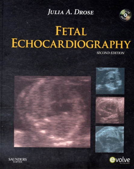 Fetal Echocardiography by Julia A. Drose - Hardback