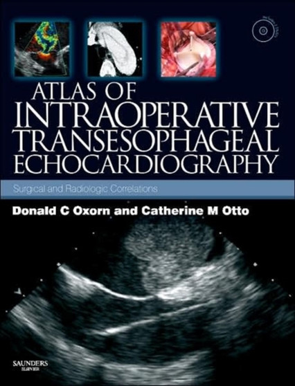 Atlas of Intraoperative Transesophageal Echocardiography : Surgical and Radiologic Correlations, Text with DVD by Donald Oxorn - Hardback