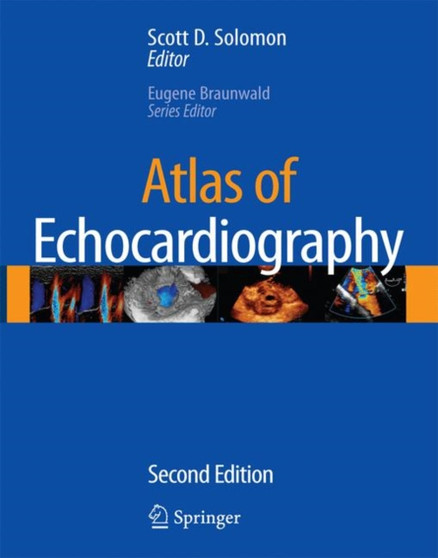 Atlas of Echocardiography by Scott D. Solomon - Hardback