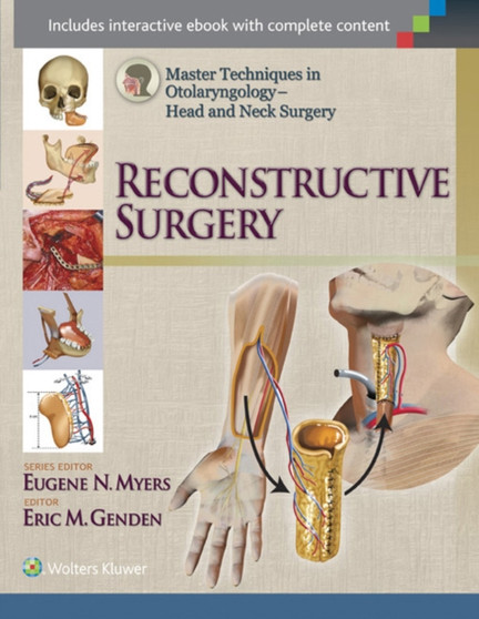 Master Techniques in Otolaryngology - Head and Neck Surgery: Reconstructive Surgery by Eric MD Genden - Hardback