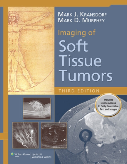 Imaging of Soft Tissue Tumors by Mark Kransdorf - Hardback