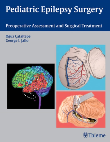 Pediatric Epilepsy Surgery : Preoperative Assessment and Surgical Treatment by Oguz Cataltepe - Hardback