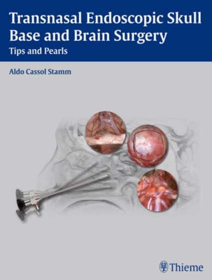 Transnasal Endoscopic Skull Base and Brain Surgery : Tips and Pearls by Aldo C. Stamm - Hardback