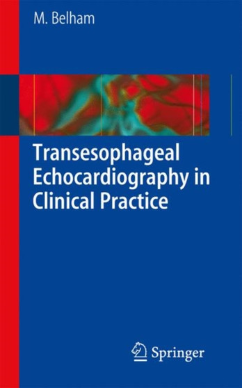 Transesophageal Echocardiography in Clinical Practice by Mark Belham - Paperback