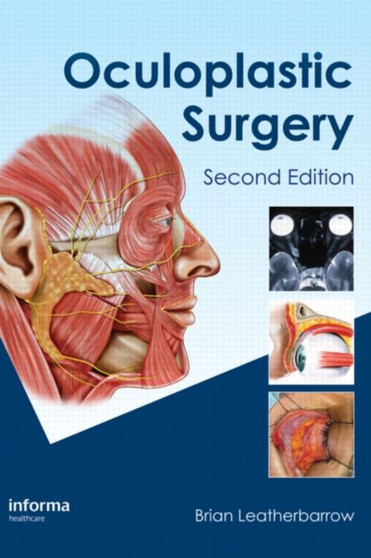 Oculoplastic Surgery by Brian Leatherbarrow - Hardback