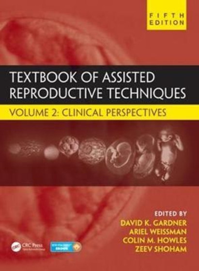 Textbook of Assisted Reproductive Techniques : Volume 2: Clinical Perspectives by Ariel Weissman - Hardback