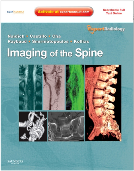 Imaging of the Spine : Expert Radiology Series, Expert Consult-Online and Print by Thomas P. MD Naidich - Hardback