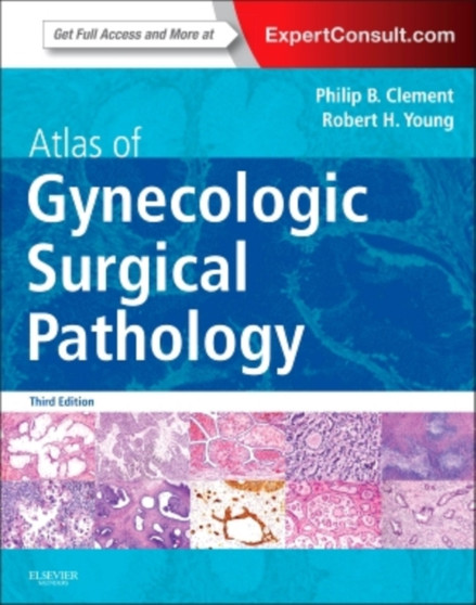 Atlas of Gynecologic Surgical Pathology : Expert Consult: Online and Print by Philip B. Clement - Hardback