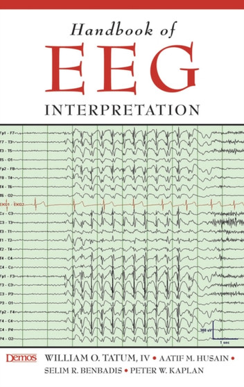 Handbook of EEG Interpretation by William Tatum - Paperback