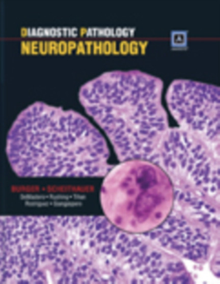 Diagnostic Pathology: Neuropathology by Peter Burger - Hardback