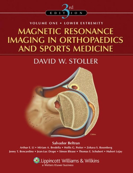 Magnetic Resonance Imaging in Orthopaedics and Sports Medicine by David W. MD FACR Stoller - Hardback