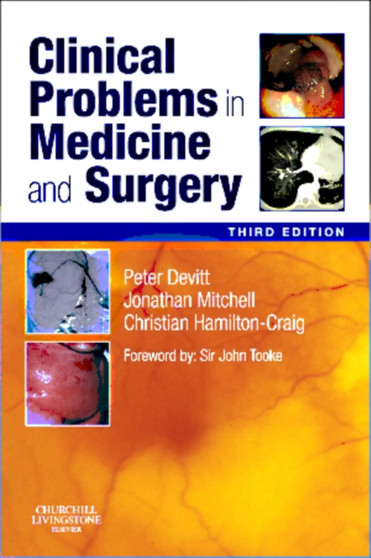 Clinical Problems in Medicine and Surgery by Peter G. Devitt - Paperback
