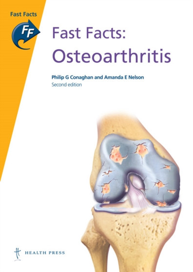 Fast Facts: Osteoarthritis by Philip Conaghan - Paperback