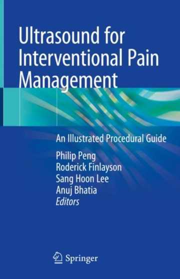 Ultrasound for Interventional Pain Management : An Illustrated Procedural Guide by Philip Peng - Hardback