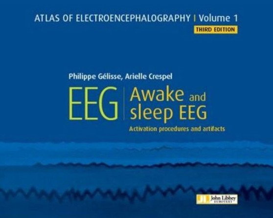 Atlas of Electroencephalography -- Volume 1 : Awake and sleep EEG by Dr Philippe Gelisse - Hardback