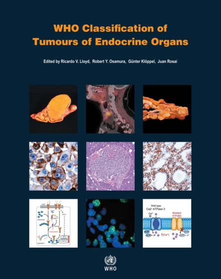 WHO classification of tumours of endocrine organs by International Agency for Research on Cancer - Paperback